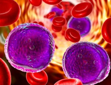 Λευχαιμία – λέμφωμα: Σε τι διαφέρουν – Τί πρέπει να ξέρετε